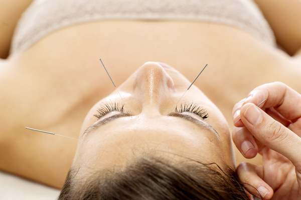 Cosmetic Acupuncture