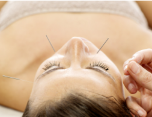 Facial Rejuvenation Acupuncture: A natural approach to anti-aging – by Louisa Dalla Riva