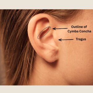 Auricular Acupuncture