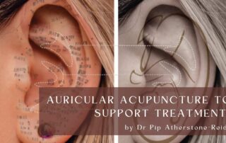 Auricular Acupuncture